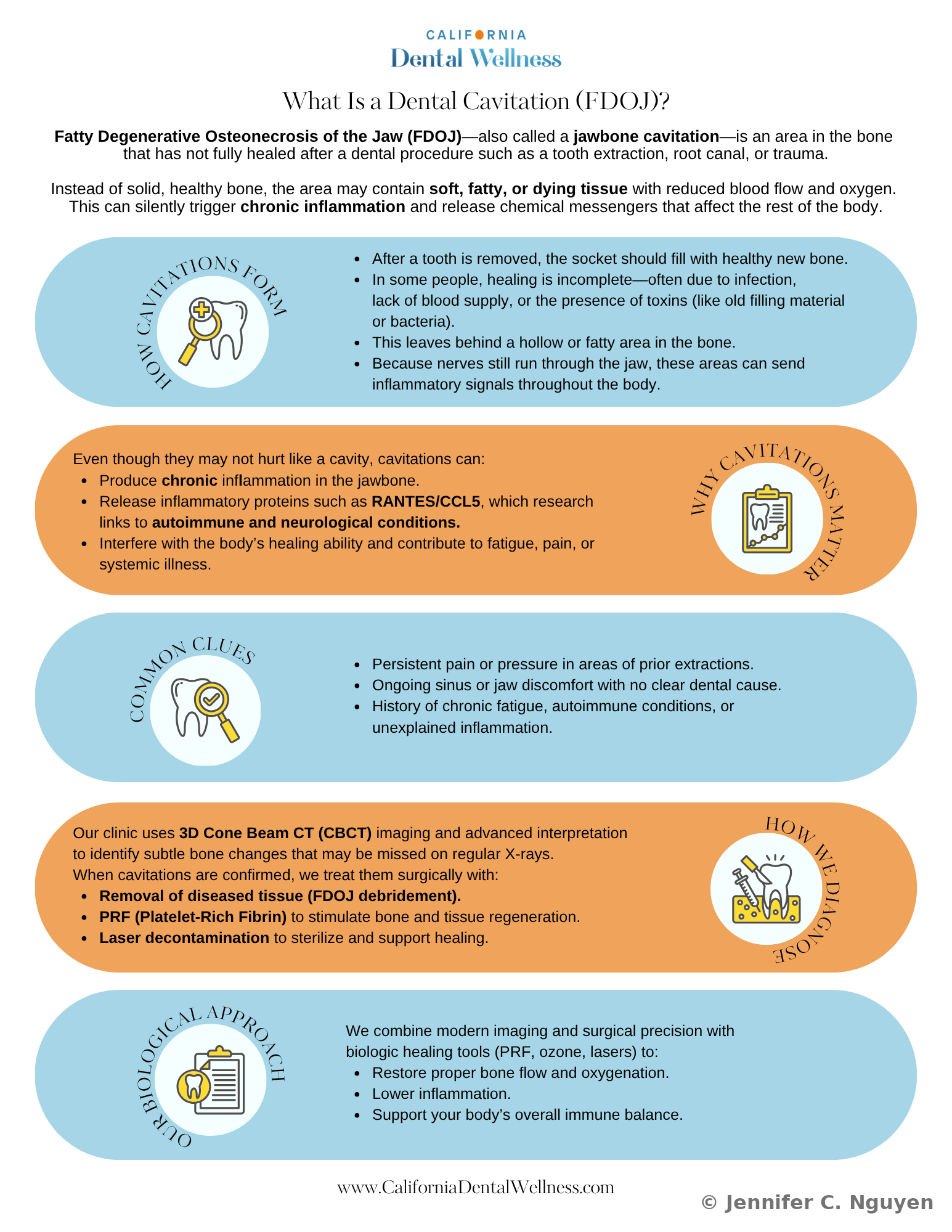 Front of a two-page patient education flyer for California Dental Wellness titled What Is a Dental Cavitation (FDOJ)?, explaining fatty degenerative osteonecrosis of the jaw through five color-coded sections: How Cavitations Form, Why Cavitations Matter, Common Clues, How We Diagnose, and Our Biological Approach, each paired with a circular icon illustration